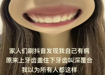 ​深覆合都是美女？深覆合会下巴短还会有很重的法令纹？