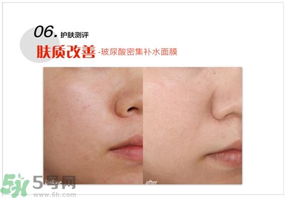 home facialpro玻尿酸密集补水面膜怎么样与使用方法