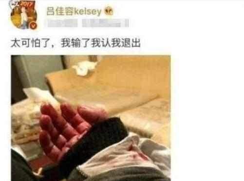 又一当红女星患抑郁症，深夜割腕自杀，疑因不堪忍受娱乐圈潜规则